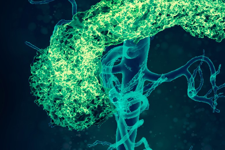 Кардио-метаболические нарушения